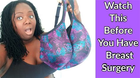 Things You Need To Know Before Breast Reduction Surgery Going From K