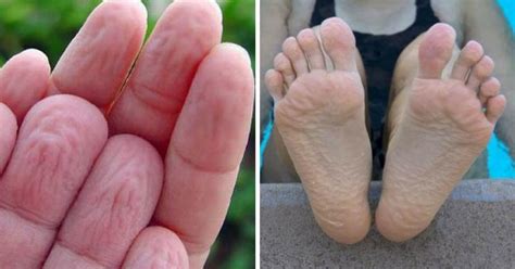Why Our Fingers And Toes Wrinkle When Wet
