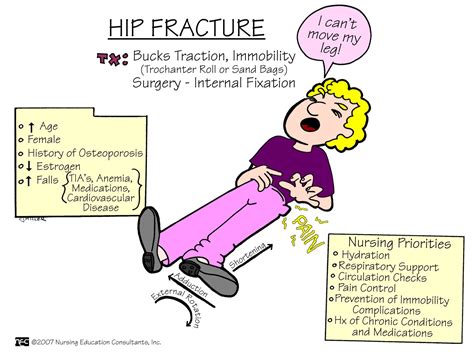 Hip Fracture Nursing Mnemonics And Tips Nursing Mnemonics Medical