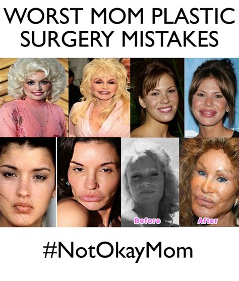 Quote About Plastic Surgery 25 Celebrities Say How They Really Feel