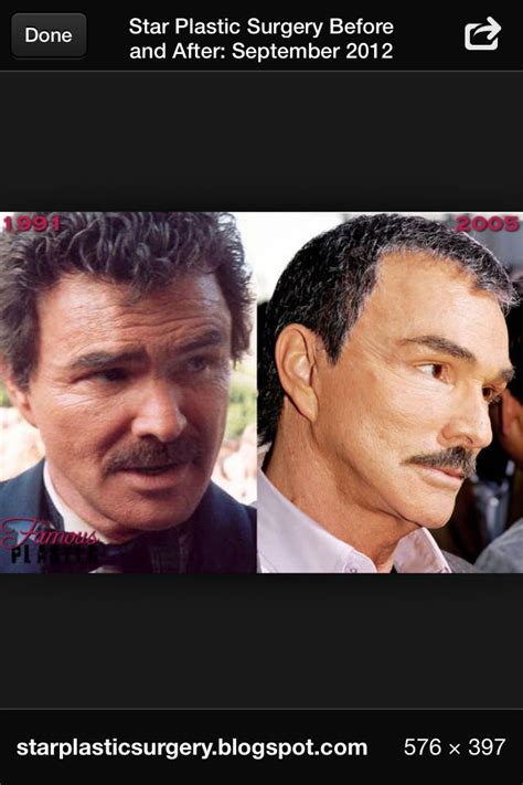 But he is thought to have undergone . Pin by Marlene Delong on Actors plastic surgery gone wrong ...