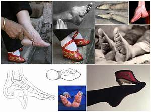 In The 11th Century Wealthy Chinese Families Started Foot Binding At