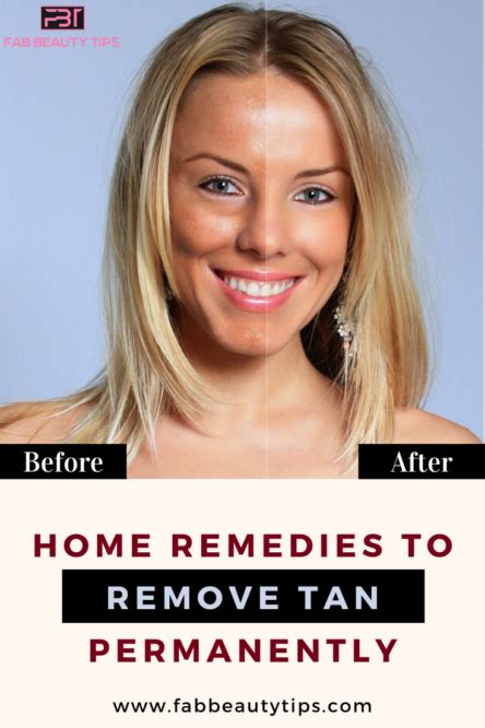 Top 30 Home Remedies To Remove Tan Permanently Fab Beauty Tips