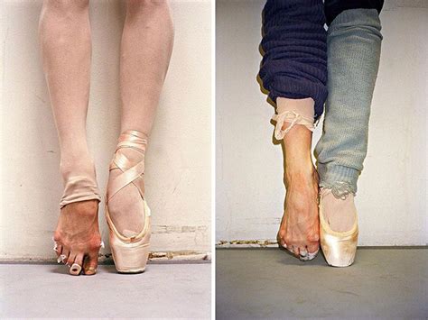 15 Pictures Showing The Pain And Glory Of Ballet Trendfrenzy
