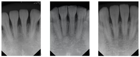 Sensors Free Full Text Detection Of Dental Apical Lesions Using