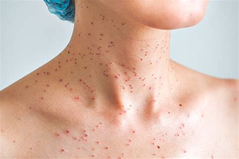 What Causes Red Spots On Skin