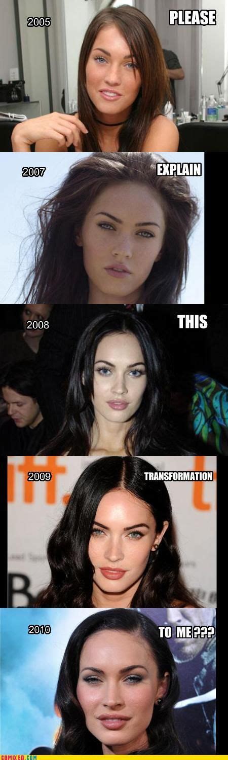 122 Best Celebrities Before And After Plastic Surgery Images Plastic