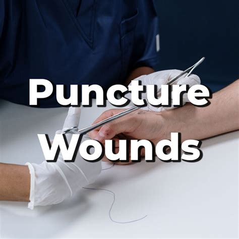 Safe Puncture Wound Treatment Wound Care Oc