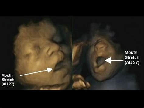 Fetus yawning reveals brain development - CBS News
