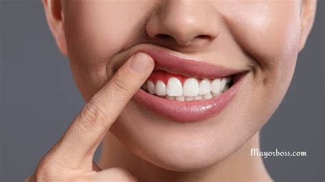6 Early Signs Of Gum Disease