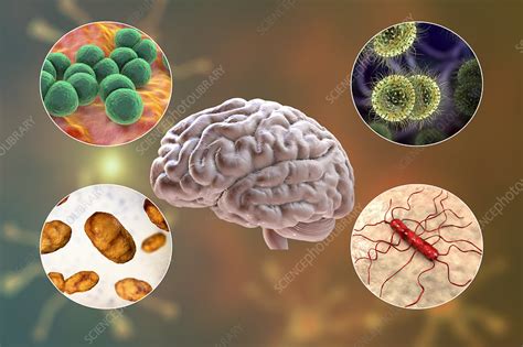 Pathophysiology Of Bacterial Meningitis