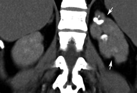 His problem list includes renal parenchymal disease. Radiodiagnosis - Imaging is Amazing-Interesting cases ...