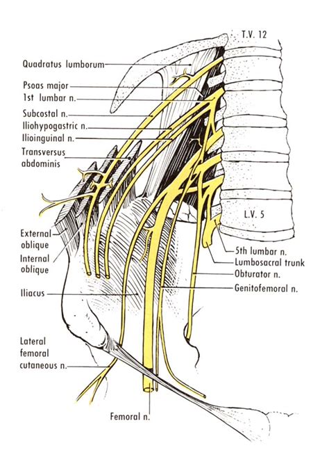 Ilioinguinal Neuralgia