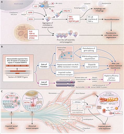 Amyotrophic Lateral Sclerosis Nejm