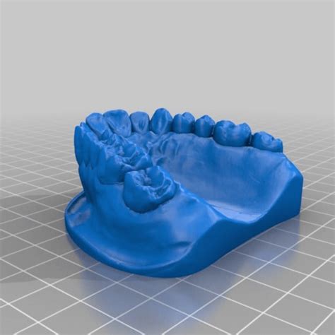 Download Stl File Dental Model 3d Printable Template ・ Cults