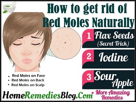 Red Moles How To Get Rid Of Red Moles Naturally Home Remedies Blog