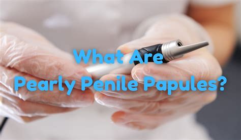 What Are Pearly Penile Papules Be Wise Professor