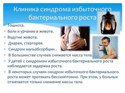 Синдром слепой кишечной петли - СИБР, SIBO - Здоровы с нами Картинка - Синдром слепой кишечной петли - СИБР, SIBO - Здоровы с нами