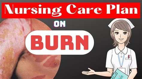 Nursing Care Plan Of Burn Injury Ncp For Burns Burn Injury Nursing