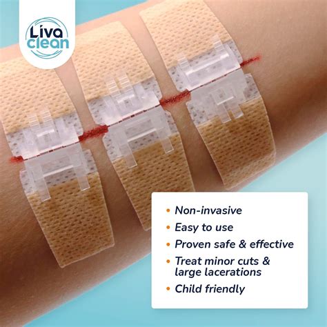 Buy 6 Ct 1 X 37 Wound Closure Strips Laceration Closure Kit Zip