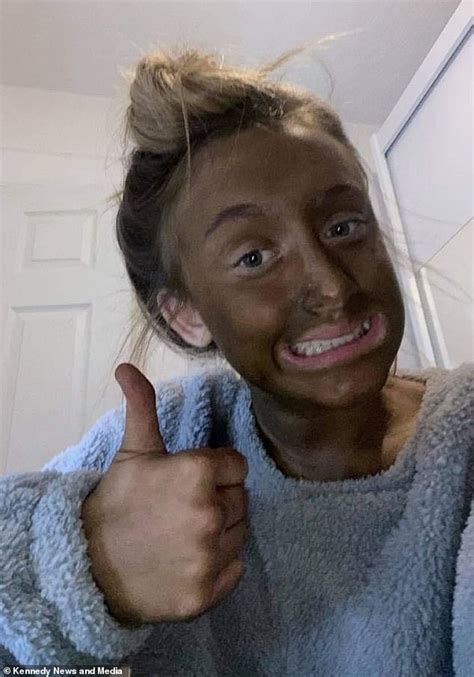 Teen Is Left Looking Like An Oompa Loompa After Grabbing The Wrong Shade Of Fake Tan Daily