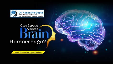 Can Stress Cause A Brain Hemorrhage Dr Himanshu Gupta