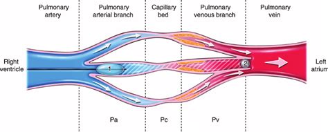 Measurement Of Pulmonary Capillary Wedge Pressure Pcwp In Pulmonary