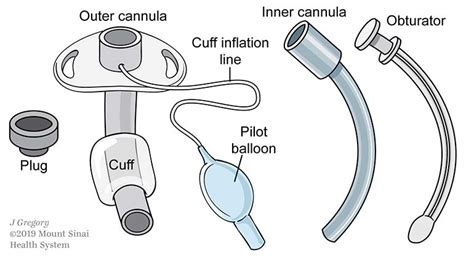 Tracheostomy Mount Sinai New York