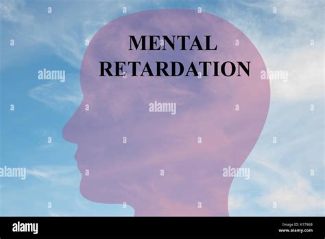 Mental Retardation Hi Res Stock Photography And Images Alamy