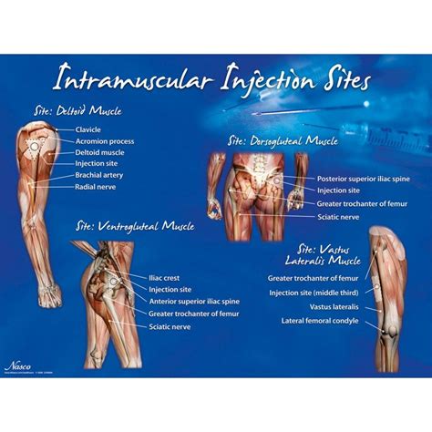 Intramuscular Injection Sites Poster Sem Trainers