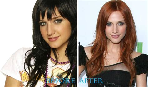 Ashlee Simpson Before And After Nose Job 12 Celebrity Plastic Surgery