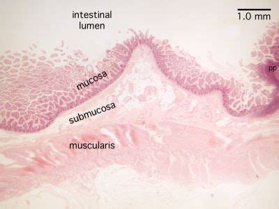 Small Intestine Histology Ileum Labels Histology Slide