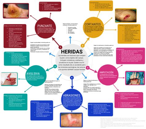 Mapa Mental Protocolo Heridas Images And Photos Finder