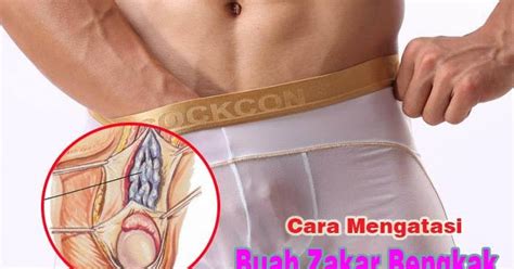 Namun, ada juga berbagai penyebab lainnya. aris hidayat: Gejala benjolan keras di buah zakar tapi ...