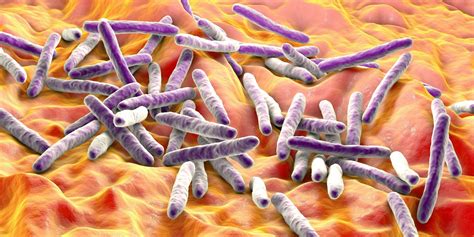 Immune Evading Mycobacterium Tuberculosis Prevents Inflammatory