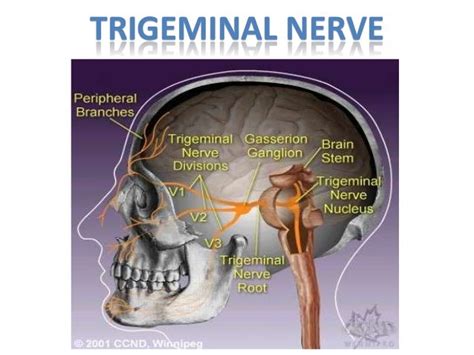 Cranial Nerve Disorders