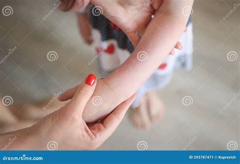 Woman Examining Red Rash On Arms Of Child Irritation On Girls Body