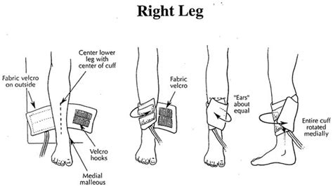 Blood Pressure Cuff Placement Right Ankle