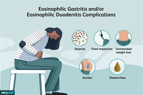 Causas y síntomas de gastritis eosinofílica y o duodenitis eosinofílica Medicina Básica