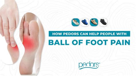 Ball Of Foot Pain Pedors Youtube