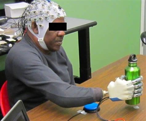Brain Machine Interface Allows Amputees To Control Bionic Hand