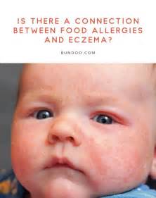 Is There A Connection Between Food Allergies And Eczema Food
