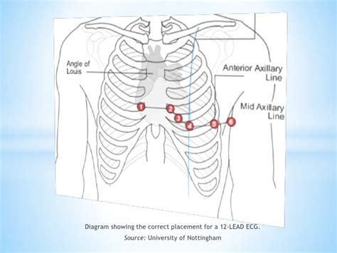 12 Lead Electrocardiogram