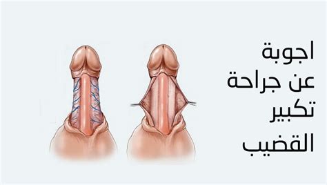 استخدمت القبائل الافريقة أسلوب الشد لتكبير أجزاء معينة من. كيفية صنع جهاز تكبير الذكر في المنزل - iroquei