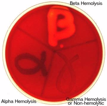 Blood agar is an enriched, bacterial growth medium. Hemolysis - Microbiology - Medbullets Step 1