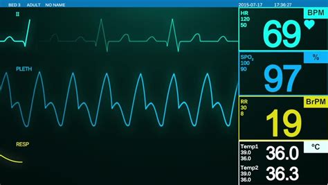 Heartbeat Monitor Screen Ecg Displays Heart Stock Footage Video 100