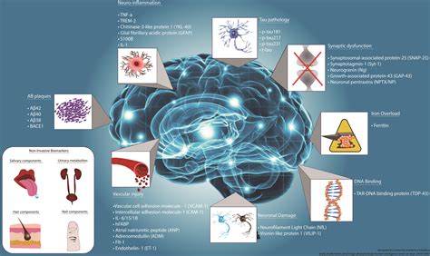Biomarkers And Their Implications In Alzheimers Disease A Literature