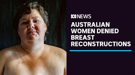 Australian Women Are Being Denied Breast Reconstructions Abc News The Global Herald