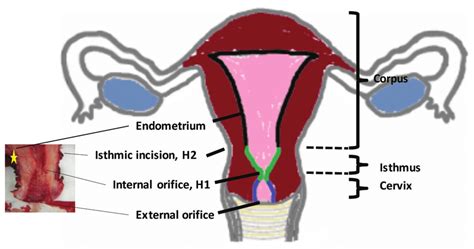 Anatomical Subdivisions Of Uterus Download Scientific Diagram