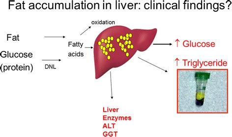 See human liver diagram stock video clips. Biochemical findings supporting excess liver fat. This ...